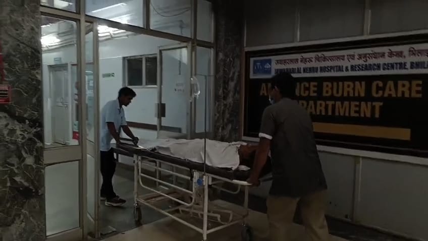 बर्न यूनिट में इलाज के लिए ले जाते हॉस्पिटल के स्टाफ।