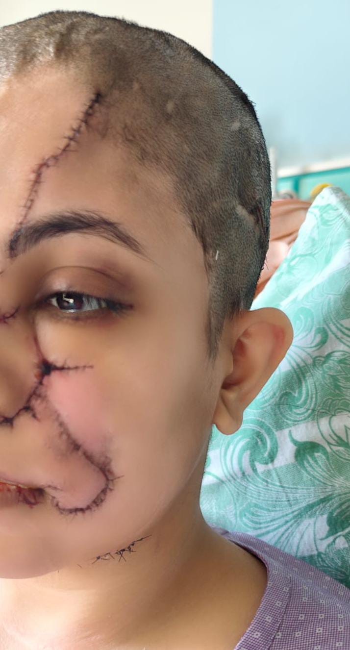 હુમલામાં મહિલાના ચહેરા પર ઈજા થઈ છે, ઘણી જગ્યાએ ટાંકા લેવાયા.