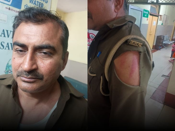 धक्का-मुक्की में कांस्टेबल मनोज की वर्दी फट गई।