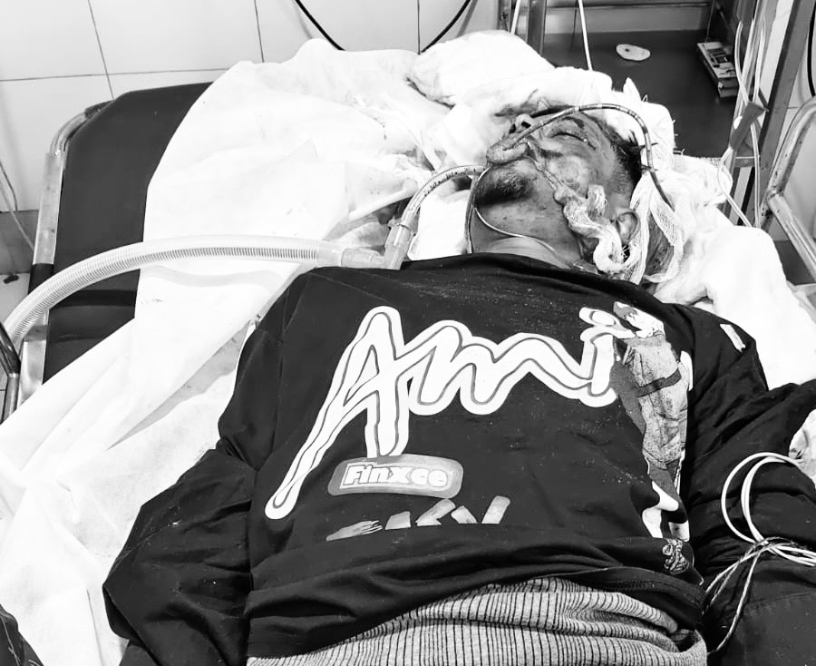 अस्पताल में वेंटिलेटर पर पड़ा शिवम