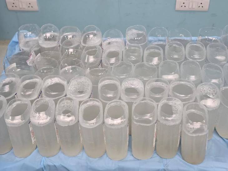 फेफड़ों को धोकर(साफ) कर इस तरह से रखा गया है।