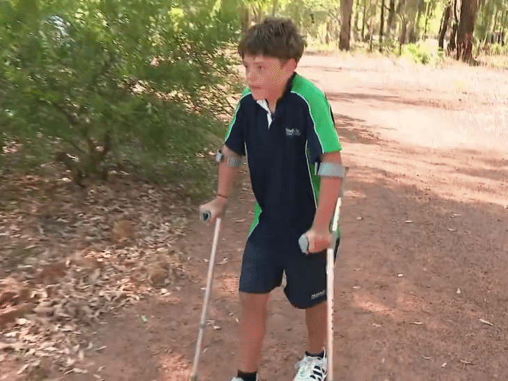 ऑस्टिन अब स्कूल लौट आया है, लेकिन उसके पैर बहुत दर्द में हैं और वो बैसाखियों के सहारे चल रहा है।