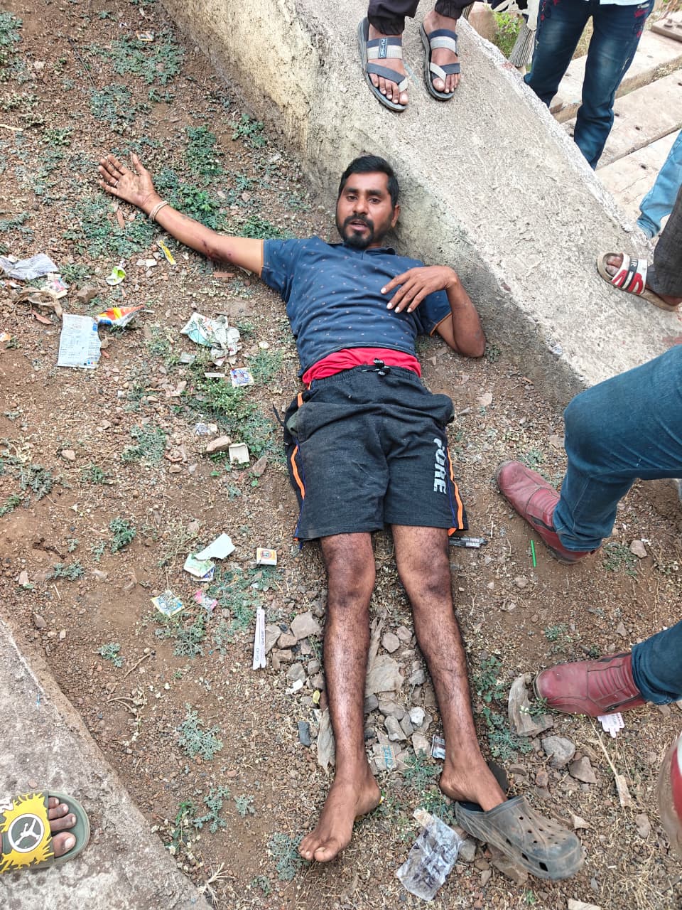 ओवरब्रिज से कूदने के बाद भी युवक की बच गई जान।