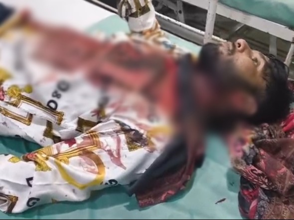 रायपुर के बैरन बाजार इलाके में युवक पर चाकू से हमला - Dainik Bhaskar