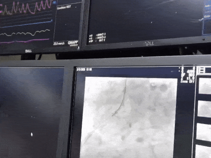 इन तकनीकों से हर नस की छोटी सी डिटेल भी स्क्रीन पर नजर आती हैं।