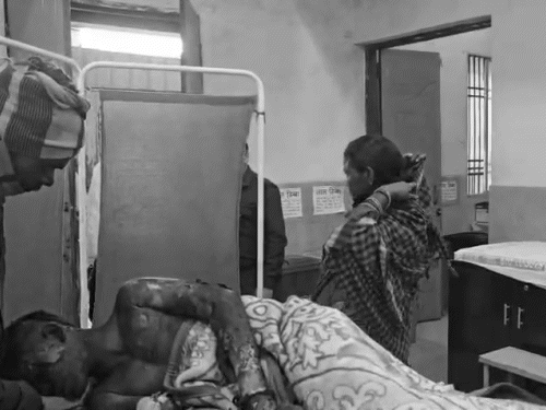 रायगढ़ के टायर प्लांट में ब्लास्ट होने से झुलसे मजदूर।