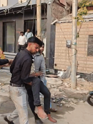 आग से झुलसे एक युवक को गंभीर हालत में अस्पताल में भर्ती कराया गया।