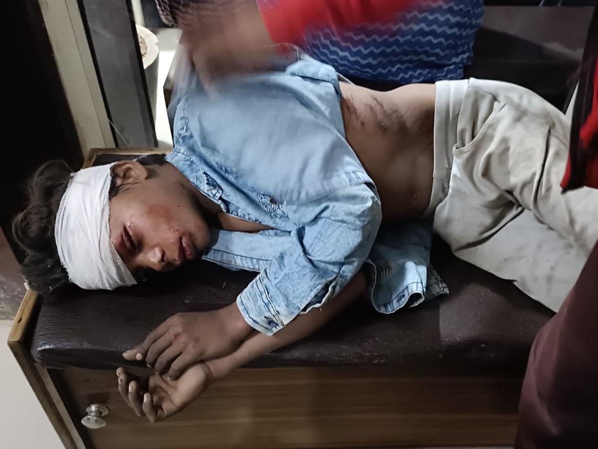 सहिजनपुर के प्रमोद कुमार के सिर और चेहरे पर गंभीर चोट आई है। सरोजनीनगर CHC में इलाज चल रहा है। हादसे में घायल लोगों की स्थिति गंभीर बनी हुई है।