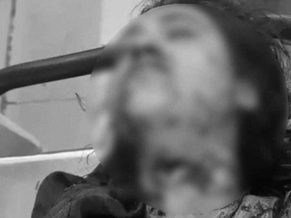 विवाद के बाद बॉयफ्रेंड ने अपनी गर्लफ्रेंड के गले पर चाकू घोंपा।