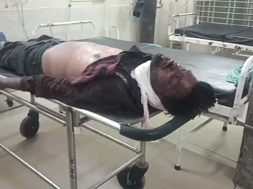 डॉक्टरों ने जांच के बाद बॉयफ्रेंड को मृत घोषित कर दिया।