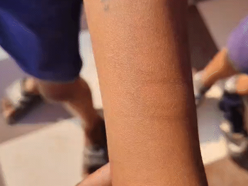 बच्चों ने कहा कि एक दूसरे को देखकर वे हाथ काटने लगे।