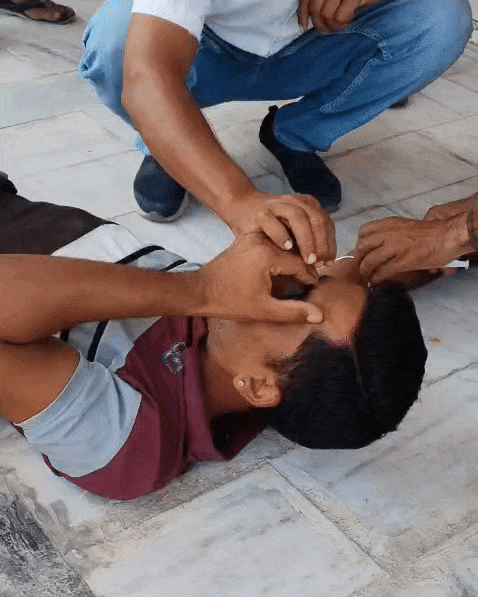 एक युवक के आंख और शरीर पर जगह-जगह मधुमक्खियों ने हमला कर दिया। इस पर लोगों ने उसे बचाया।