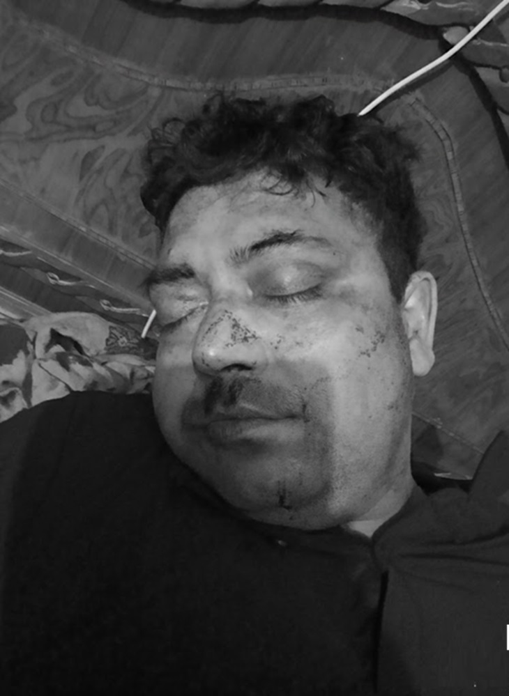 ASI Jasbir committed suicide by shooting himself in the temple. He died on the spot.