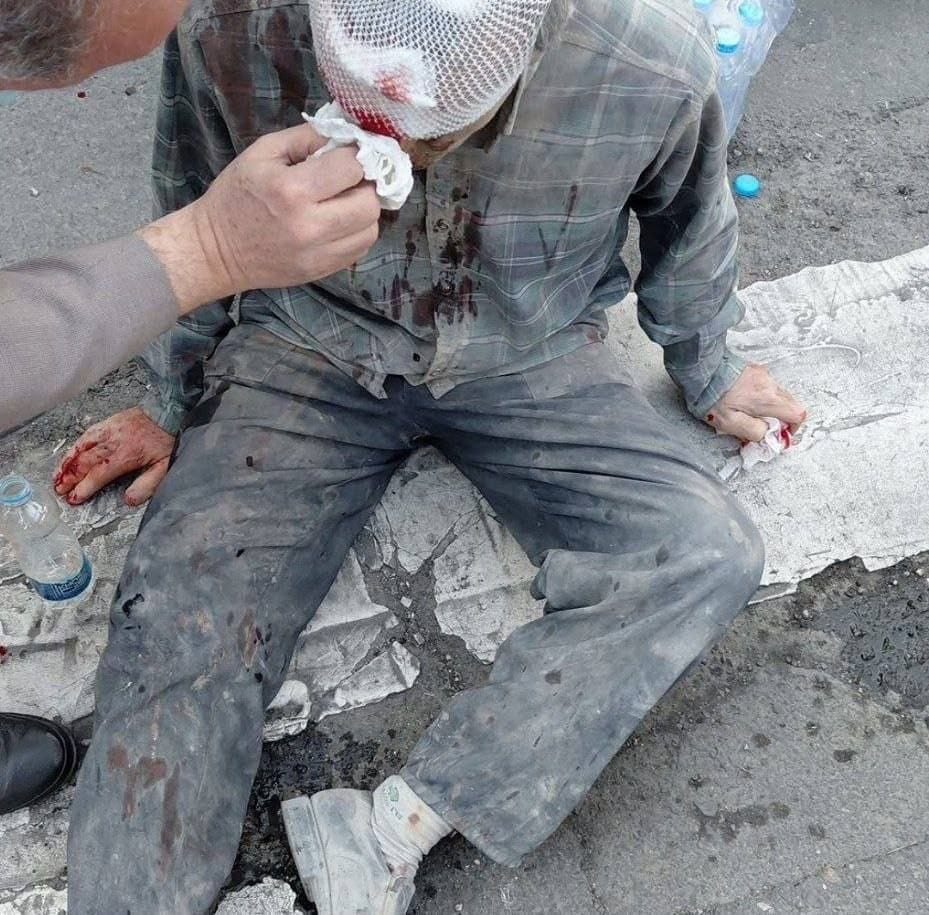 इजराइली हमले में ईरान में कई लोग घायल हुए हैं। हालांकि मृतकों या घायलों का अभी कोई आंकड़ा नहीं आया है।