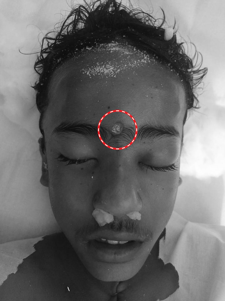 यह तस्वीर मृतक उनैज की है। बच्चे के माथे के बीचोंबीच गोली मारी गई है।