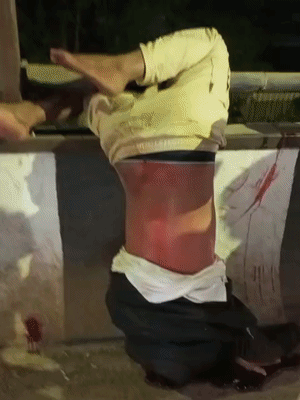 फॉर्च्यूनर की टक्कर से स्कूटी सवार MBBS छात्र की बॉडी पुल की रेलिंग से लटक गई। करीब 30 मिनट बाद पुलिस मौके पर पहुंची और छात्र को नीचे उतारकर अस्पताल ले गई।