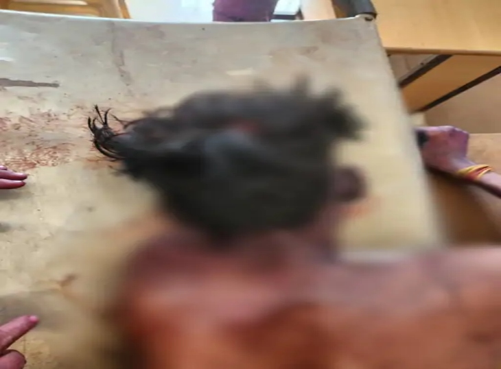 आरोपियों ने विरोध करने पर मारा था चाकू।