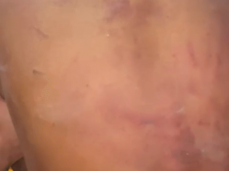 युवक की पीठ पर भी खूब मारा गया।