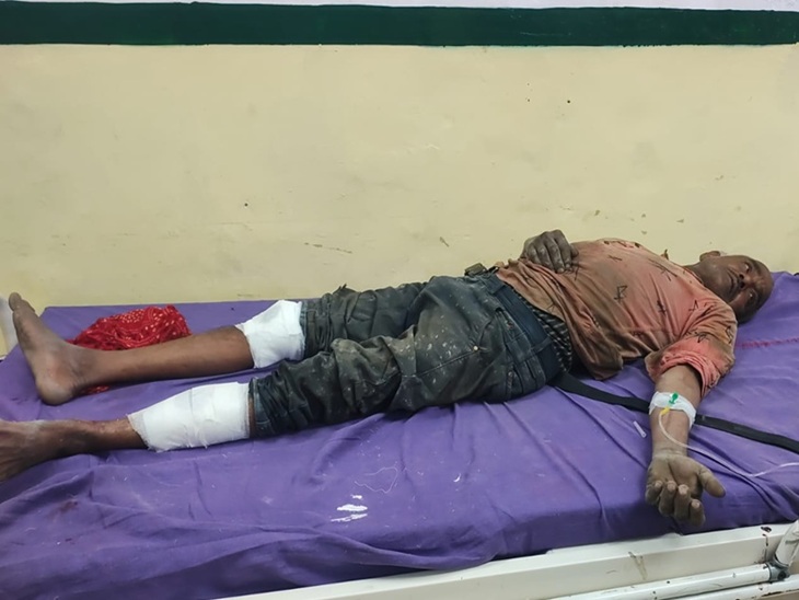 नागरिक अस्पताल में उपचाराधीन घायल।