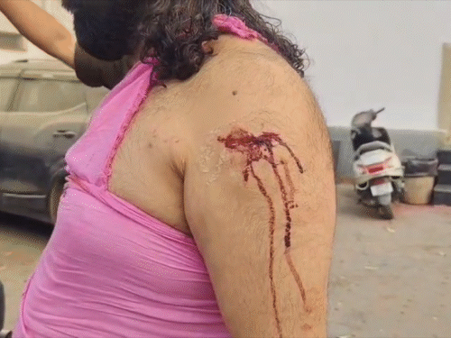 आशुतोष ब्रह्मचारी की नाक और हाथ पर चोट लगी। जीआरपी से शिकायत के बाद उन्होंने अपना इलाज कराया।