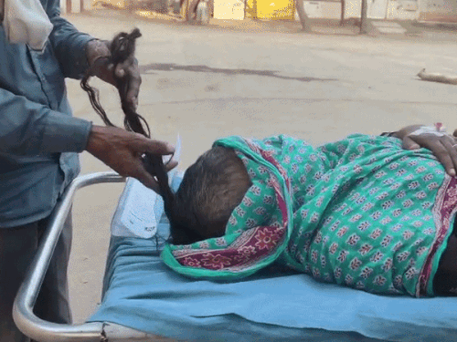 महिला के बाल काटकर उसे पीटकर घायल किया। नूंह के अस्पताल लेकर पहुंचे परिजन। - Dainik Bhaskar