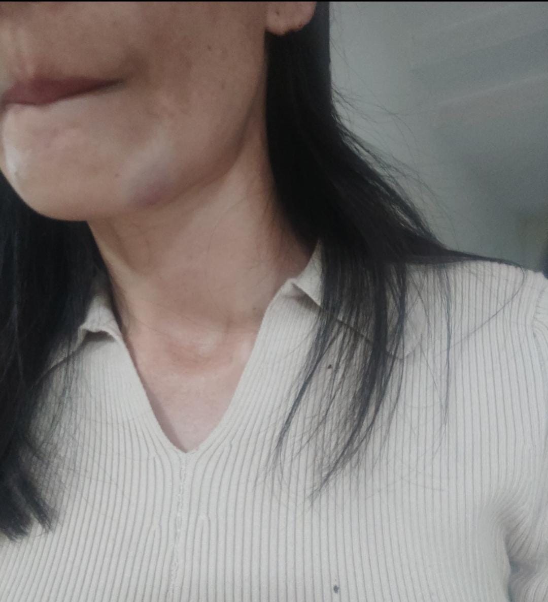 तस्वीर में पीड़ित के चेहरे पर चोट के निशान नहीं आ रहे हैं।