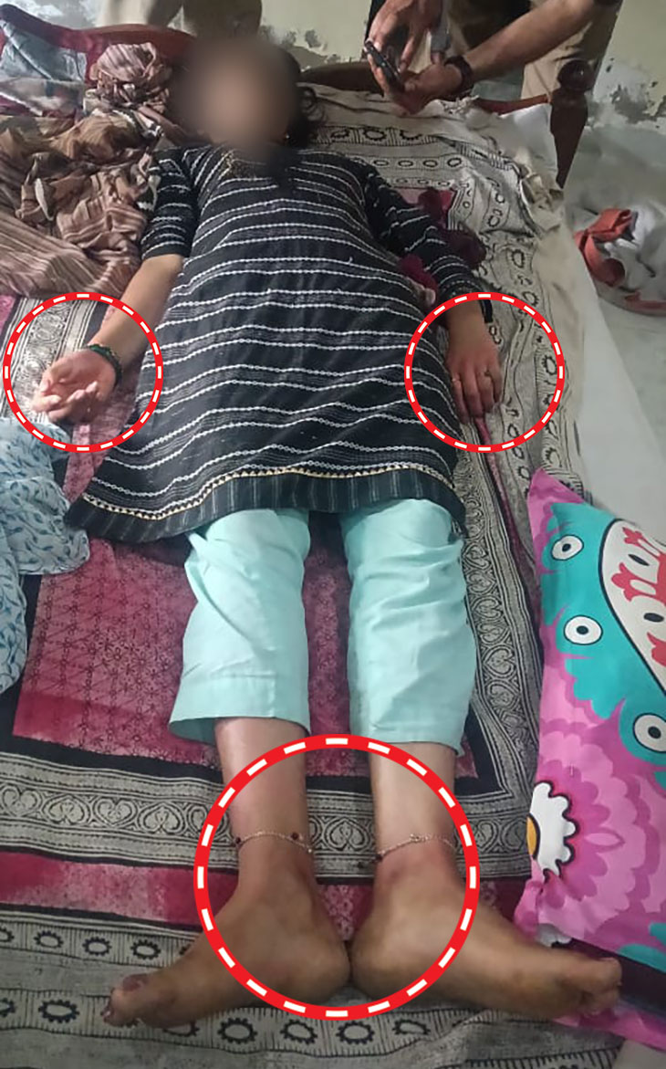 सीतापुर की रहने वाली लड़की का शव बेड पर पड़ा मिला। उसके हाथ-पैर पर बांधने के निशान थे।