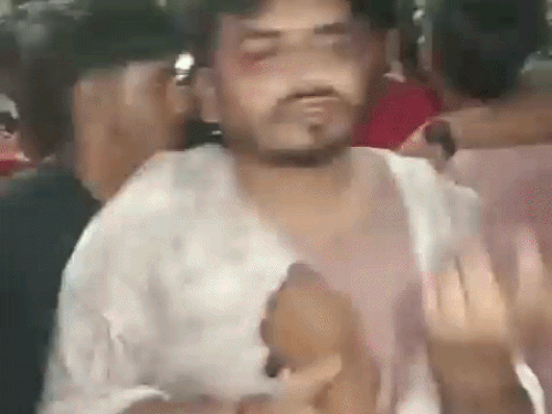 युवक को थप्पड़ लगाता स्थानीय युवक।