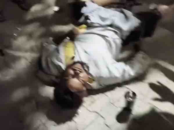 बाइक सवार रोड पर गिरा हुआ।