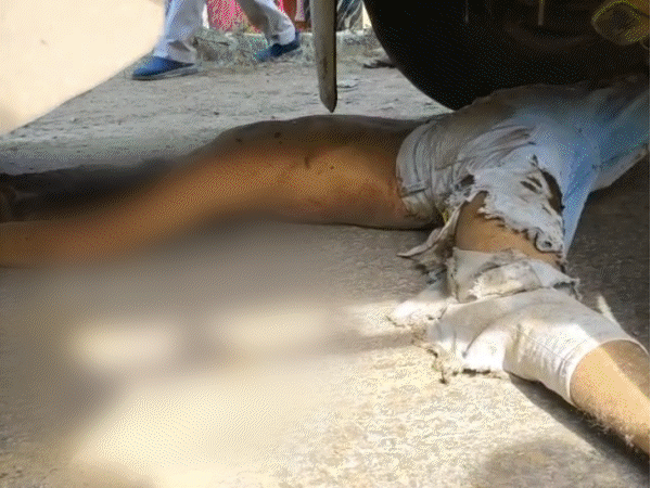 ट्रक के नीचे फंसा युवक - Dainik Bhaskar
