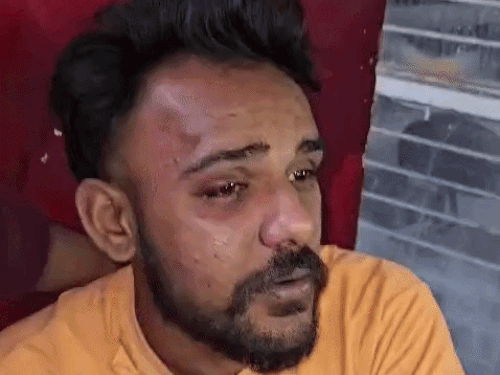 युवक जोबन प्रीत जिसने मारपीट के आरोप लगाए।