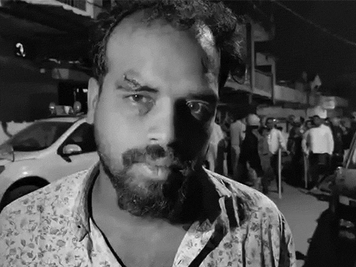 घटना में कई लोग को चोट आई है। एक शख्स के आंख के ऊपर पत्थर लगा।