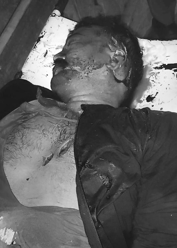 बदमाशों ने भाजपा नेता राजकुमार चौहान को घेर लिया। सिर, सीने और चेहरे पर 20-25 बार चाकू से हमला किया था।