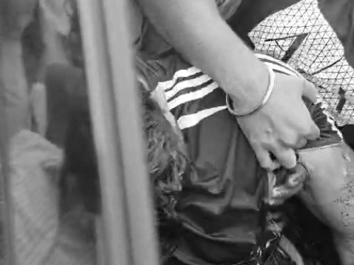 प्रॉपर्टी डीलर के बाजू में भी गोलियां लगीं।