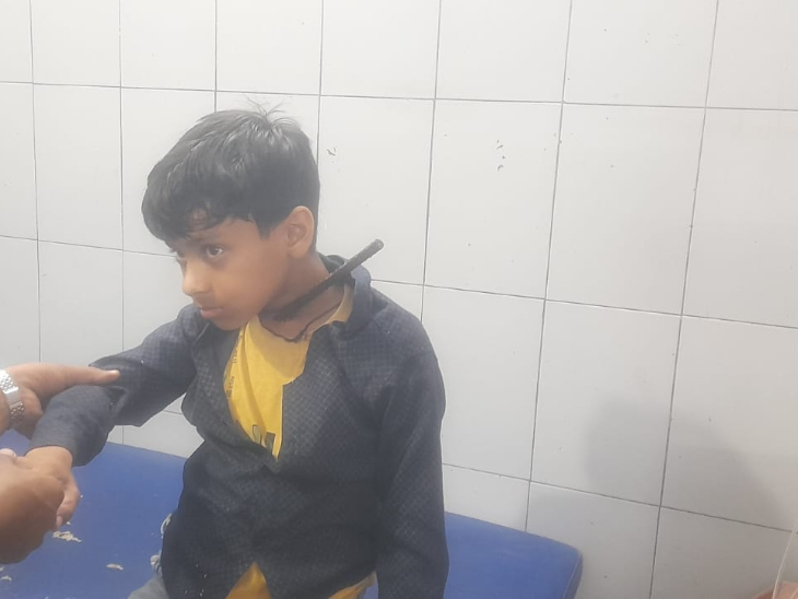 सरिया बच्चे के सीने से घुसकर गला पार करते हुए निकल गया।