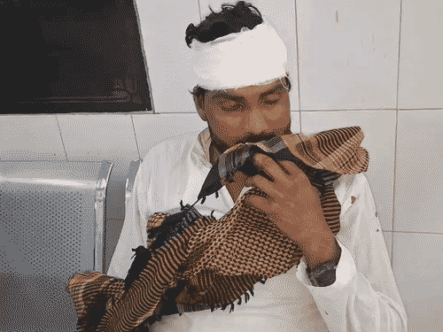 एक घायल ने बताया कि करीब 15 मिनट तक बवाल हुआ। इस दौरान जमकर धारदार हथियार चले।