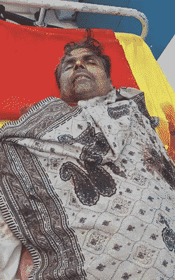 घायलों को अस्पताल में भर्ती कराया गया है। 5 लोगों की हालत गंभीर है।