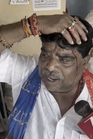 पथराव में स्थानीय लोग भी घायल हुए हैं।