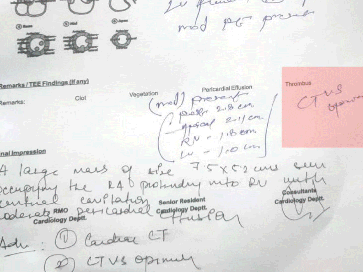 रायपुर सेंट्रल जेल में बंद बीमार कैदी योगेन्द्र कुमार बंजारे (29) की 30 मई को मौत हो गई थी।