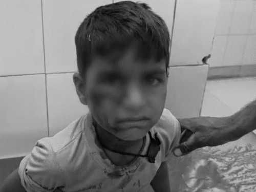 अलवर शहर में एक दिल दहला देने वाली घटना सामने आई, जहां एक 7 साल के मासूम पर आवार कुत्ते ने अचानक हमला कर दिया।