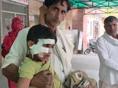 गंभीर हालत में मासूम को जिला अस्पताल में भर्ती कराया गया है, जहां घायल बच्चे का इलाज जारी है।