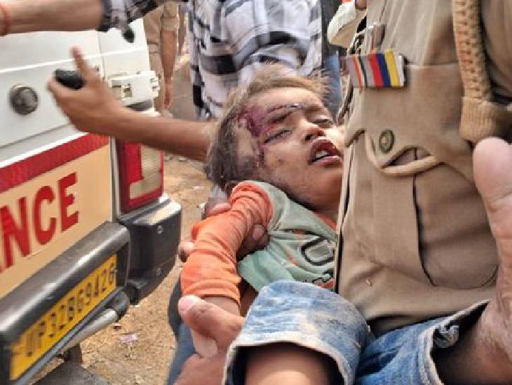 तस्वीर कार्तिक उर्फ गुड्डू की है। बच्चे का स्वरूपरानी नेहरू अस्तपाल में इलाज चल रहा है।