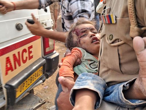 हादसे में एक बच्चा घायल हो गया। पुलिसवाले उसे गोद में उठाकर एम्बुलेंस तक ले गए। फिलहाल उसका इलाज चल रहा है।