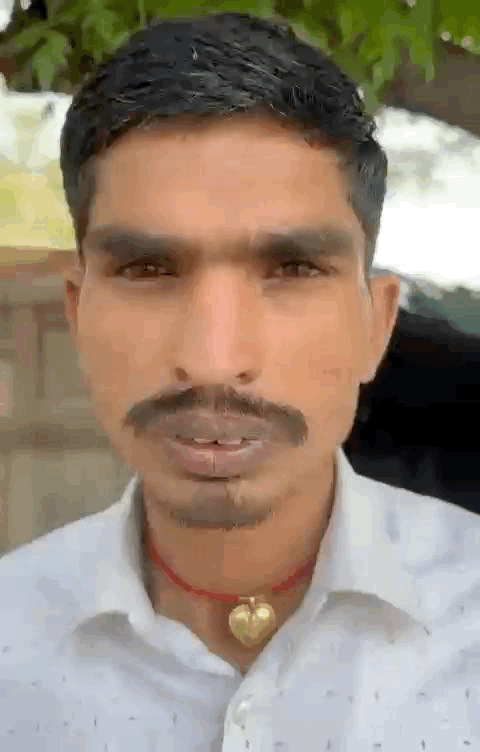 जानकारी देते हुए झुलसे युवक के चाचा मिथुन।