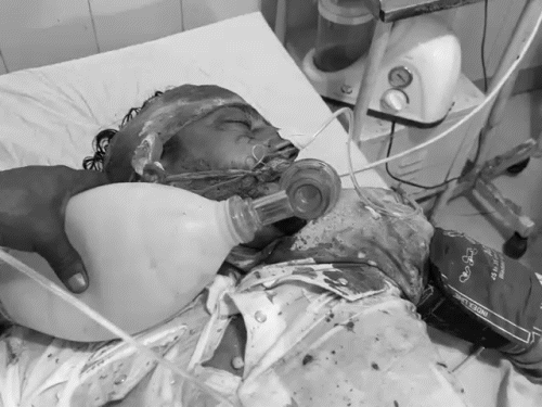 लुधियाना के अस्पताल में मृतक व्यक्ति का शव।