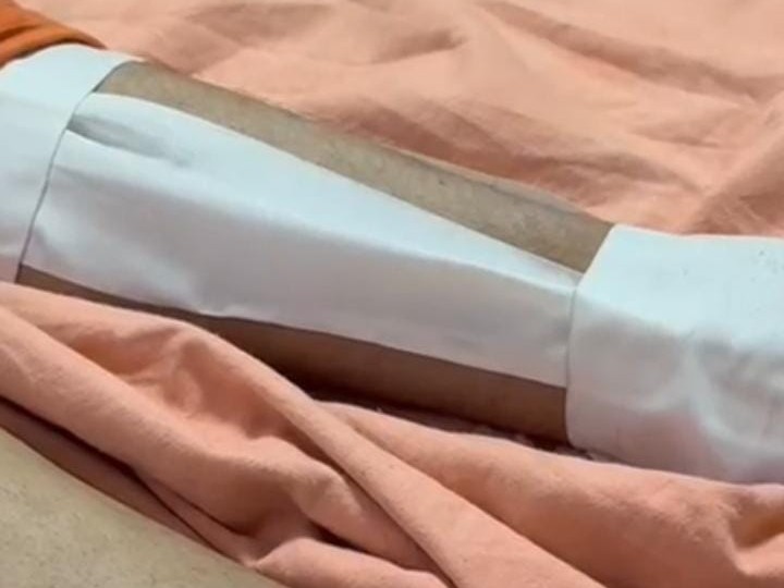 युवक के जांघ की हड्डी टूटी