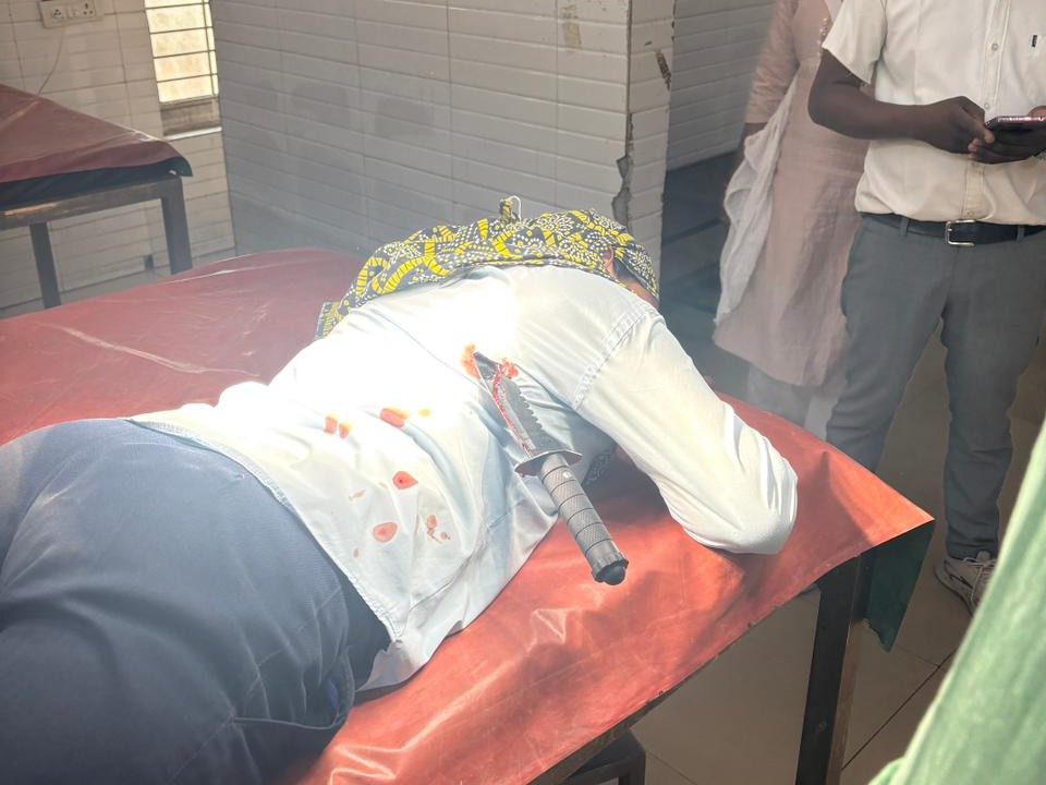 युवती की पीठ पर ऐसे फंसा रह गया चाकू। डॉक्टरों ने निकालकर इलाज किया।