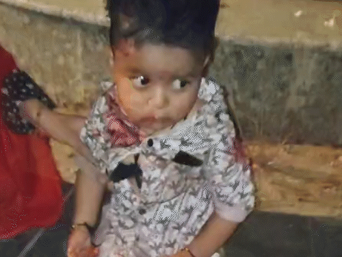 हादसे में दो बच्चे भी घायल हुए हैं।