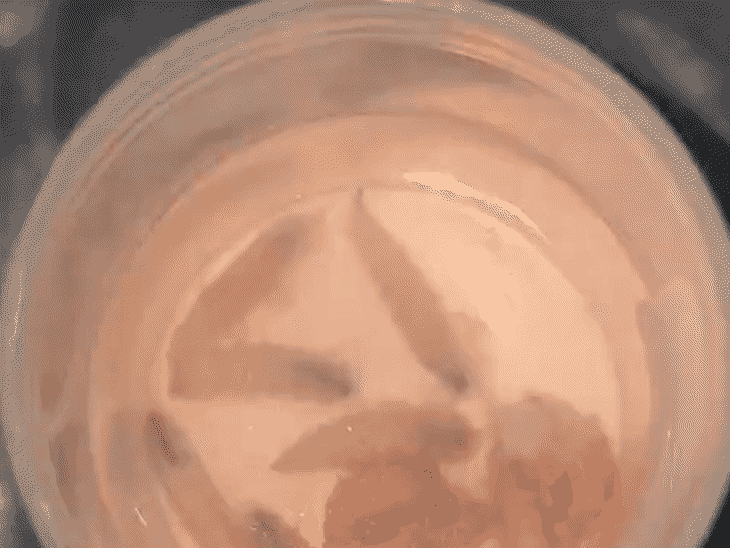 दूरबीन (एंडोस्कोपिक) तकनीक से अंदर जाकर एक-एक कर कीड़े निकाले गए।