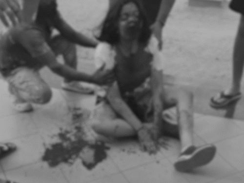 लोहे का पोल लगने से बच्ची लहूलुहान हो गई।